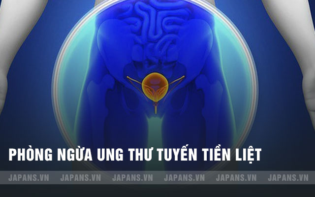 phòng ngừa ung thư tuyến tiền liệt