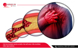 dieu tri mo mau tieu duong